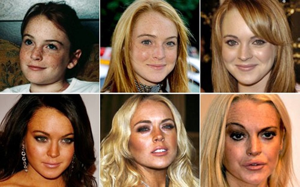 A 34 éves Lindsay Lohan mára teljesen felismerhetetlenné vált