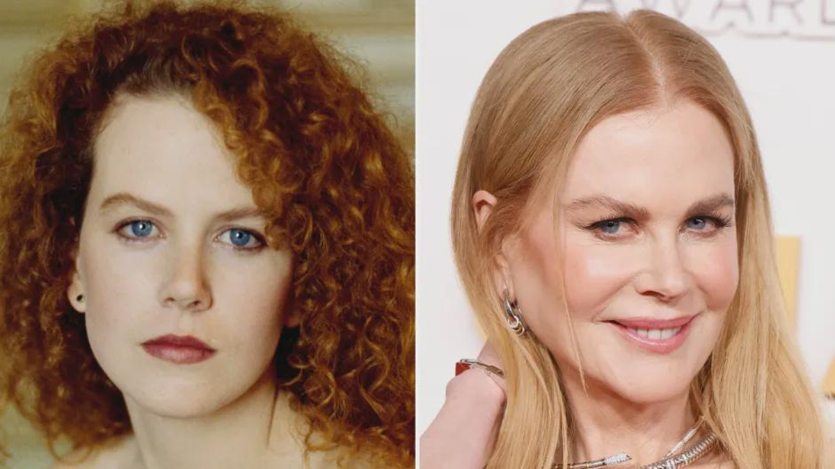 Nicole Kidman még csak 56 éves, de a sok plasztikai beavatkozástól teljesen felismerhetetlenné vált